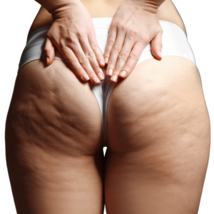 A woman wearing white underwear with her hands on her butt. There is visible cellulite on her buttocks and thighs