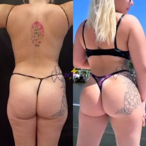 Before and after of a woman's backside who received a Brazilian butt lift